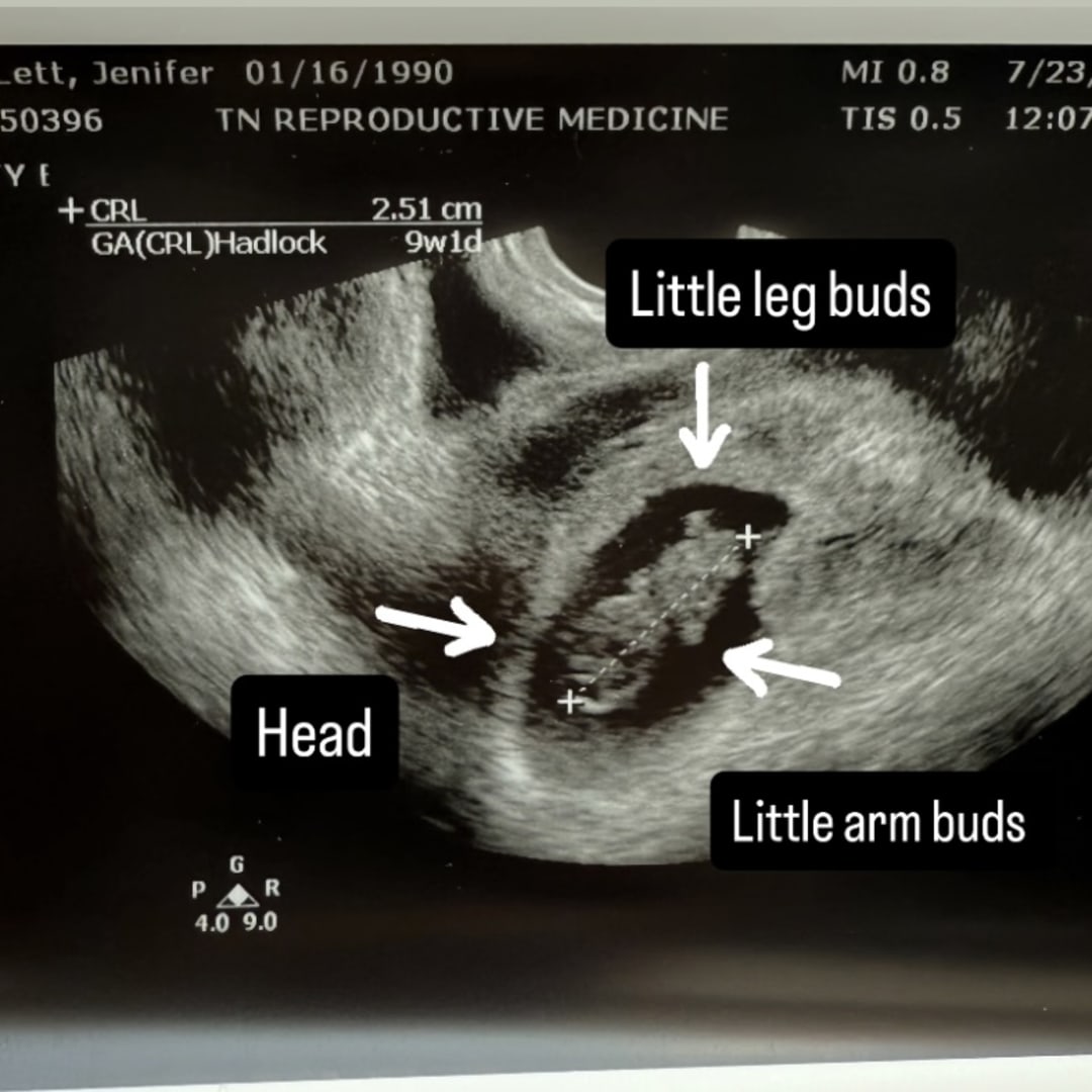 Photo shared by Jenifer & Taylor for their Babylist baby registry.
