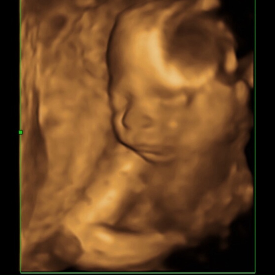 Photo shared by Alexis for their Babylist baby registry.