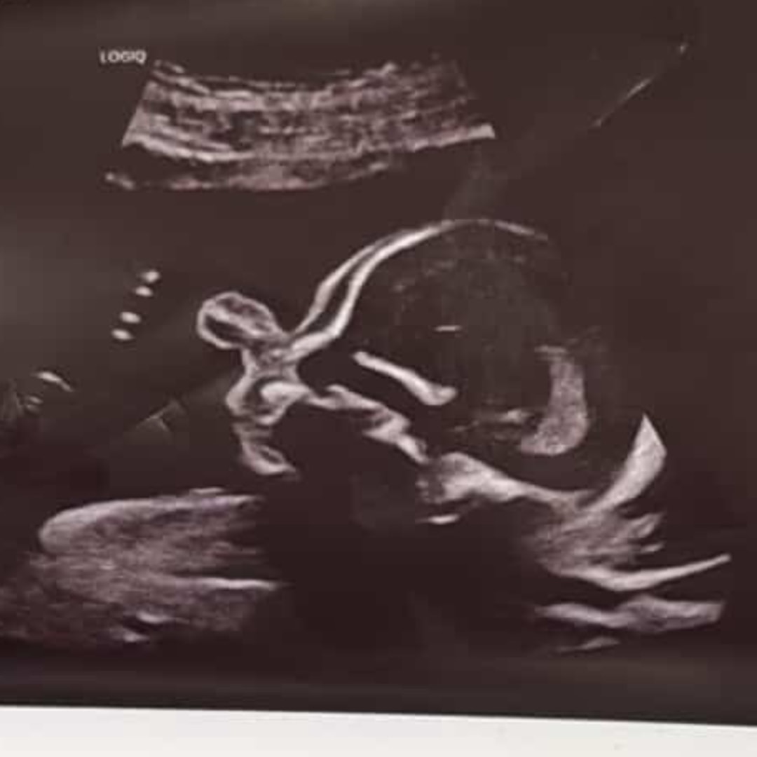 Photo shared by Arianna for their Babylist baby registry.