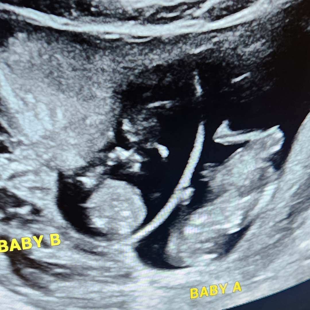 Photo shared by Tia for their Babylist baby registry.