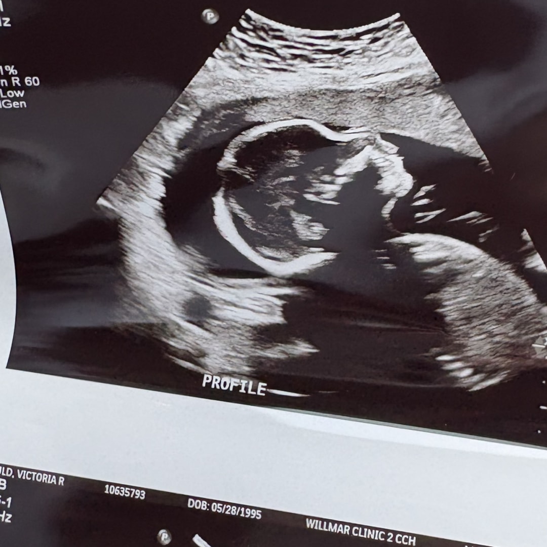 Photo shared by Victoria for their Babylist baby registry.