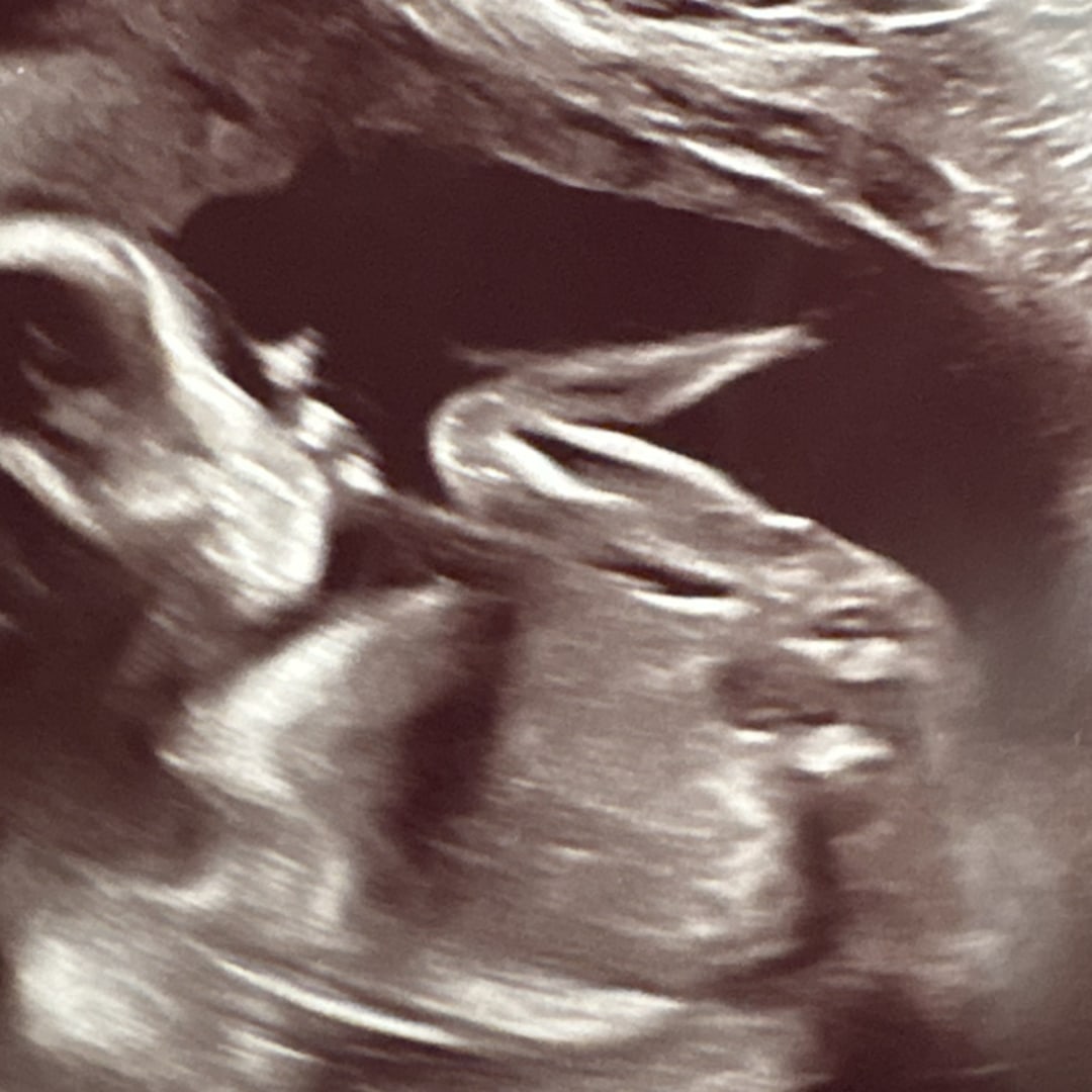 Photo shared by Olivia for their Babylist baby registry.