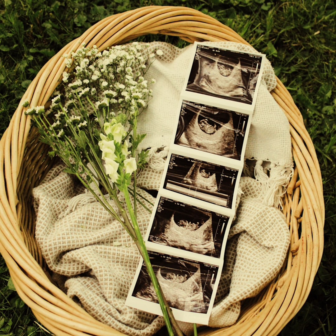 Photo shared by Zoey for their Babylist baby registry.