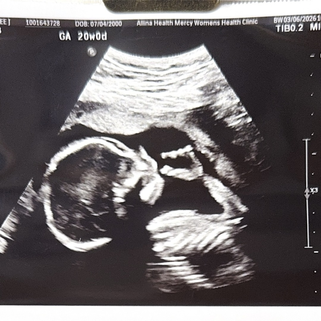 Photo shared by Kylee for their Babylist baby registry.