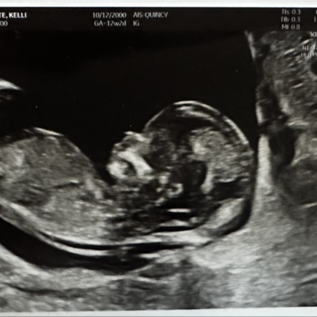 Photo shared by Kelli for their Babylist baby registry.