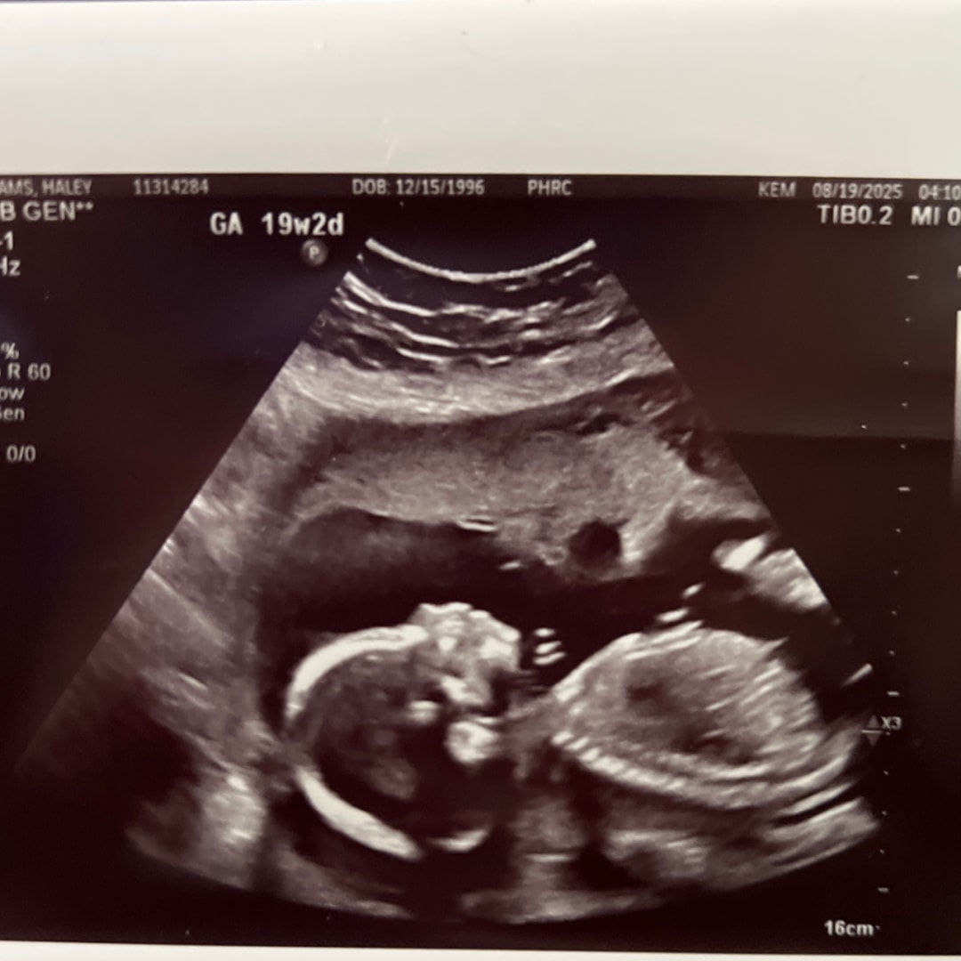 Photo shared by Haley for their Babylist baby registry.