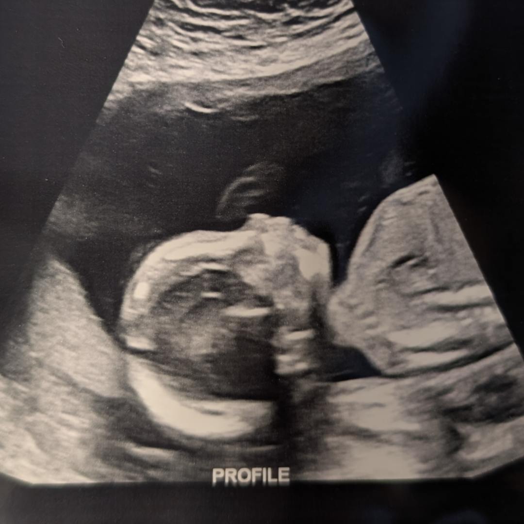 Photo shared by Cassidy for their Babylist baby registry.