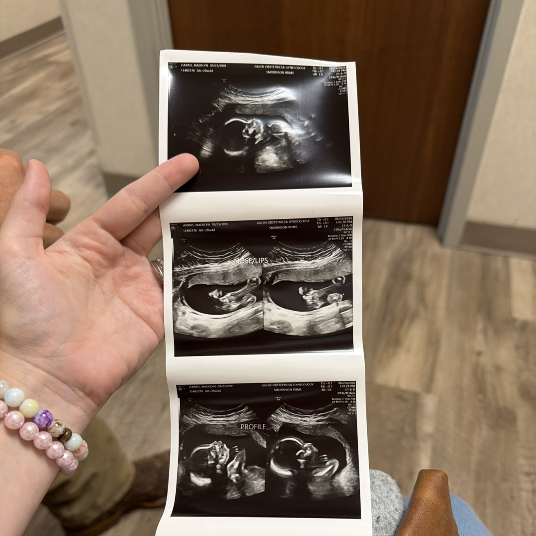 Photo shared by Madelyn for their Babylist baby registry.