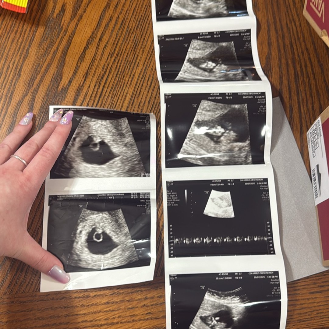 Photo shared by Kenzi for their Babylist baby registry.