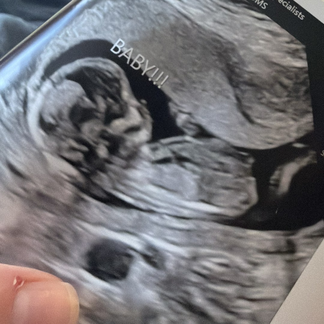 Photo shared by Mackenzie for their Babylist baby registry.