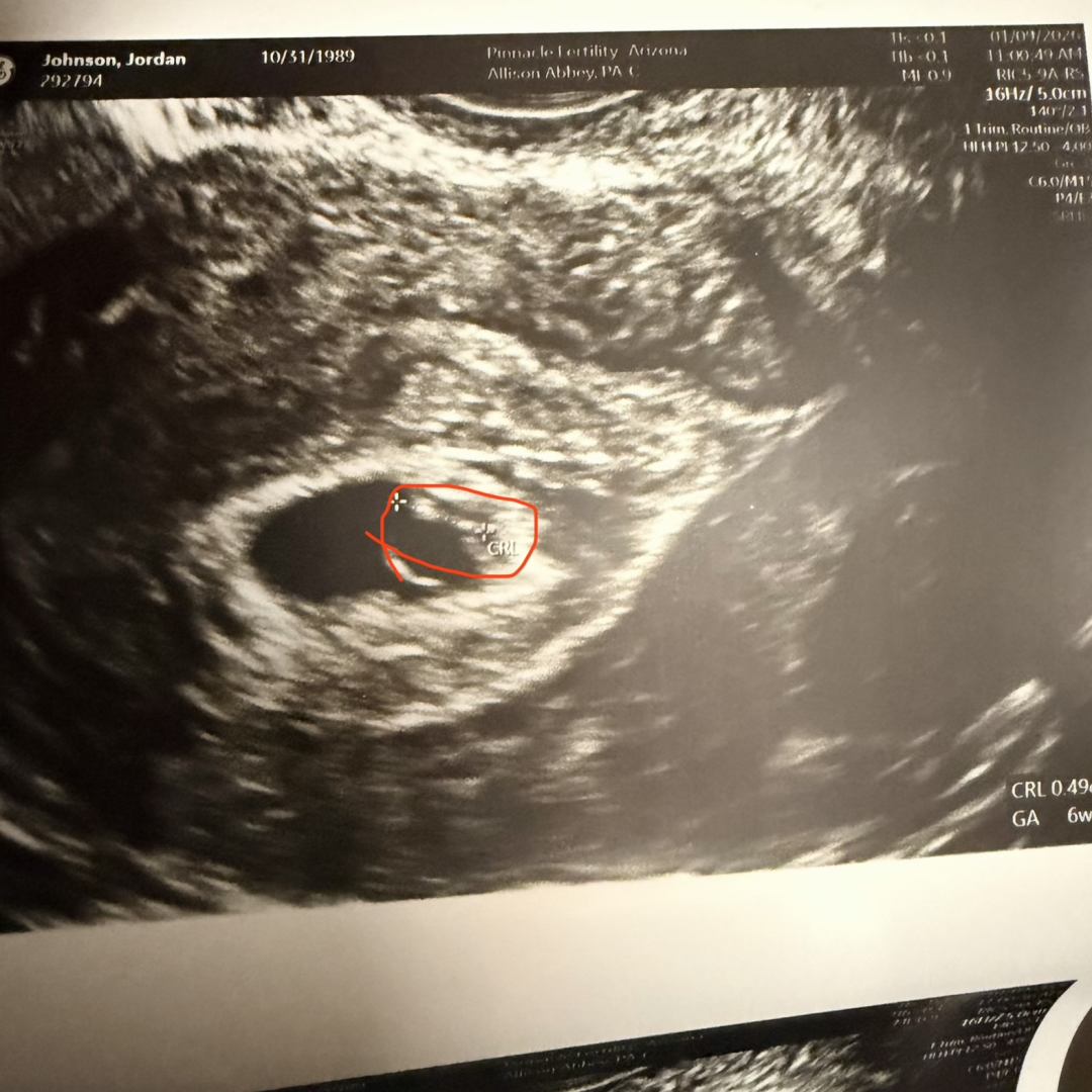 Photo shared by Jordan for their Babylist baby registry.