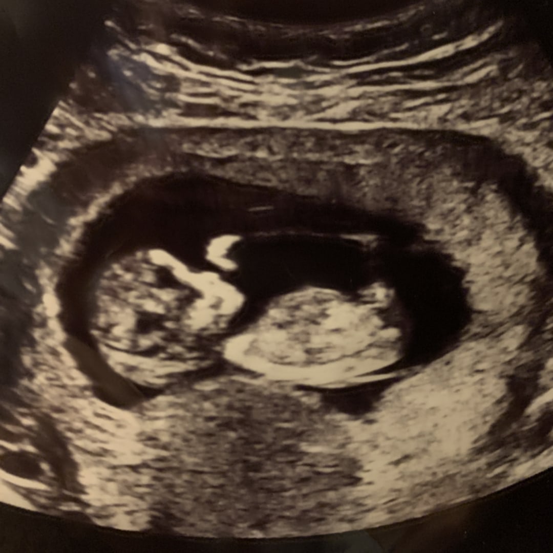 Photo shared by Mikayla for their Babylist baby registry.