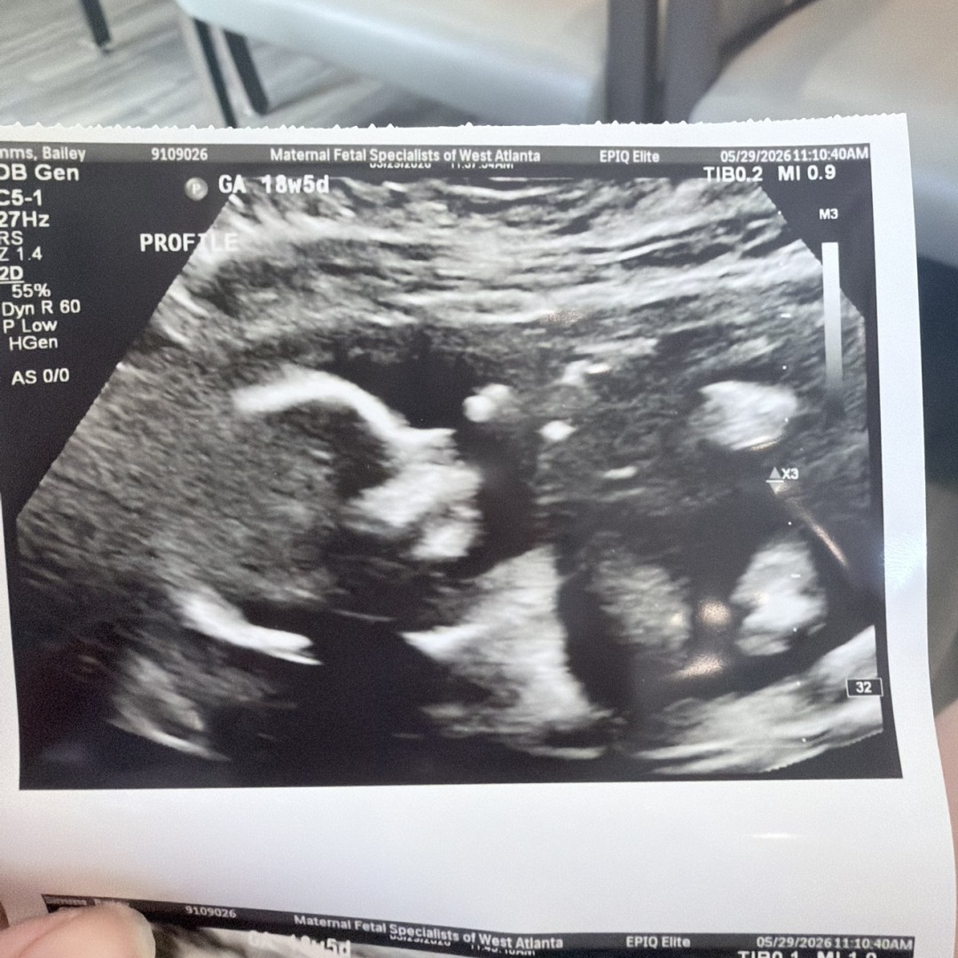 Photo shared by Bailey for their Babylist baby registry.