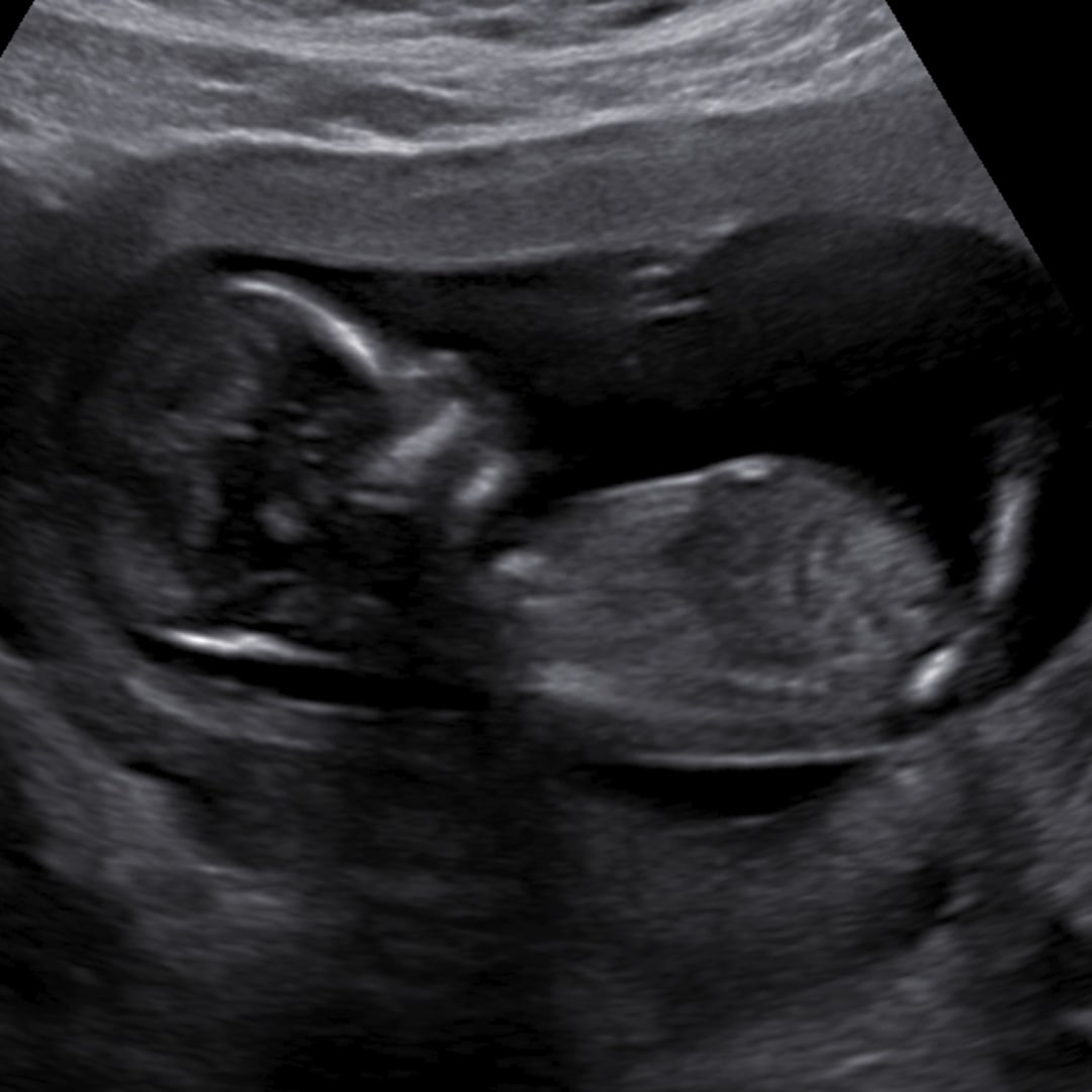 Photo shared by Amayrany for their Babylist baby registry.