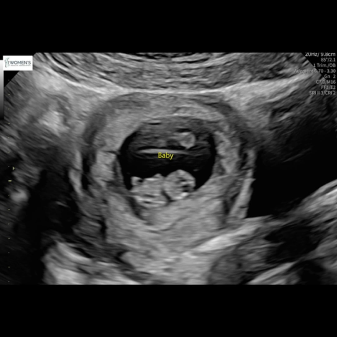 Photo shared by Bethany for their Babylist baby registry.