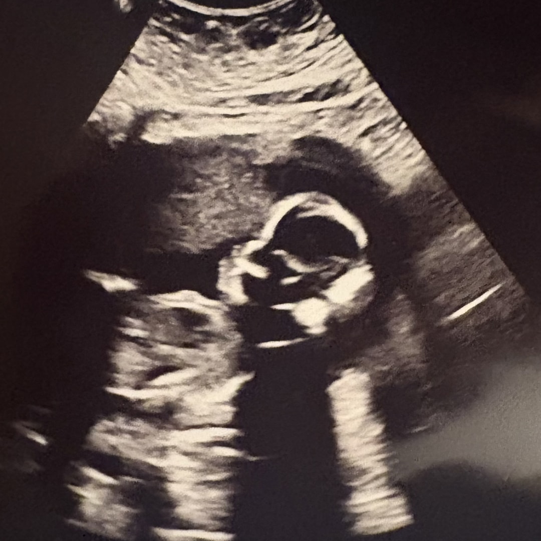 Photo shared by Michelle for their Babylist baby registry.