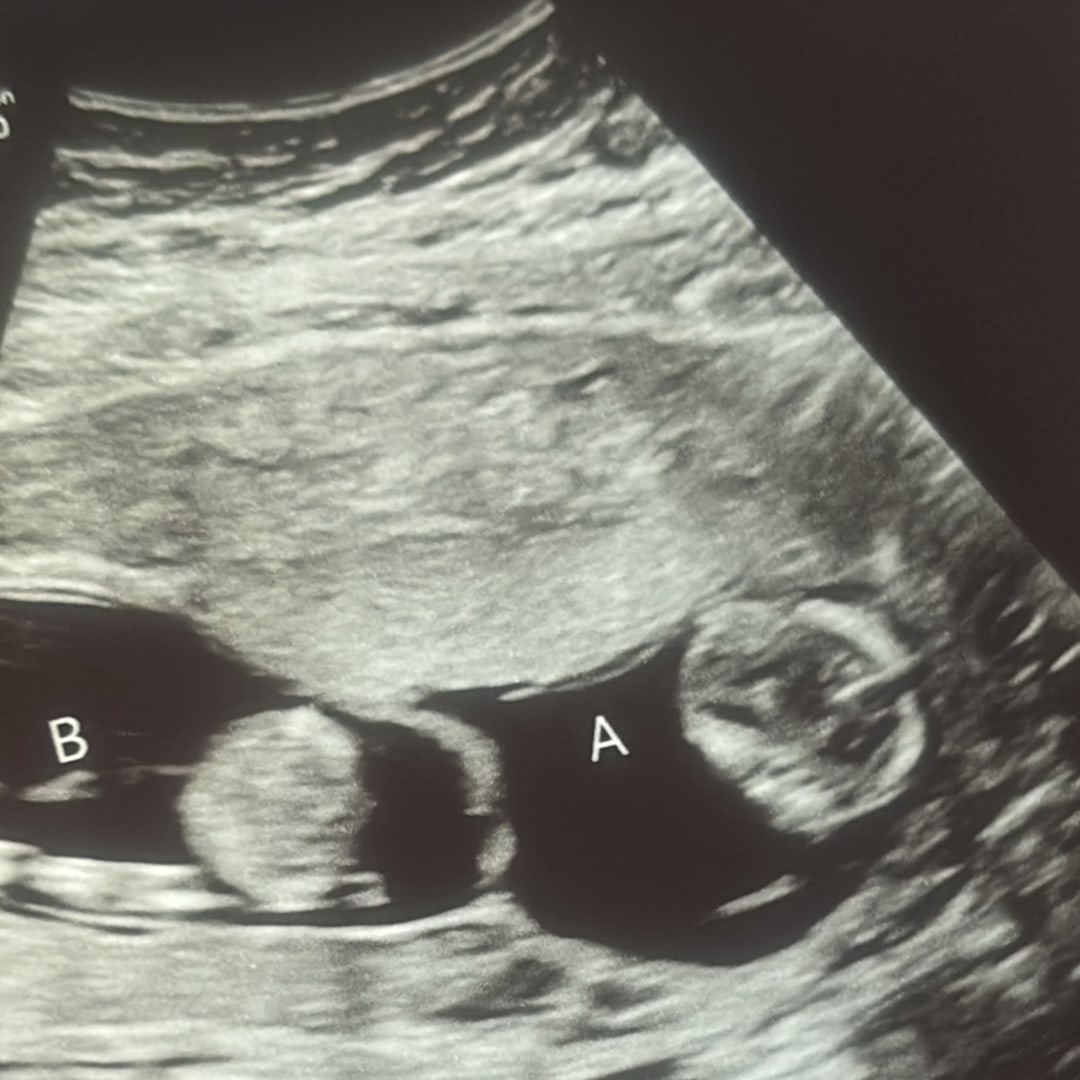 Photo shared by Barbara for their Babylist baby registry.