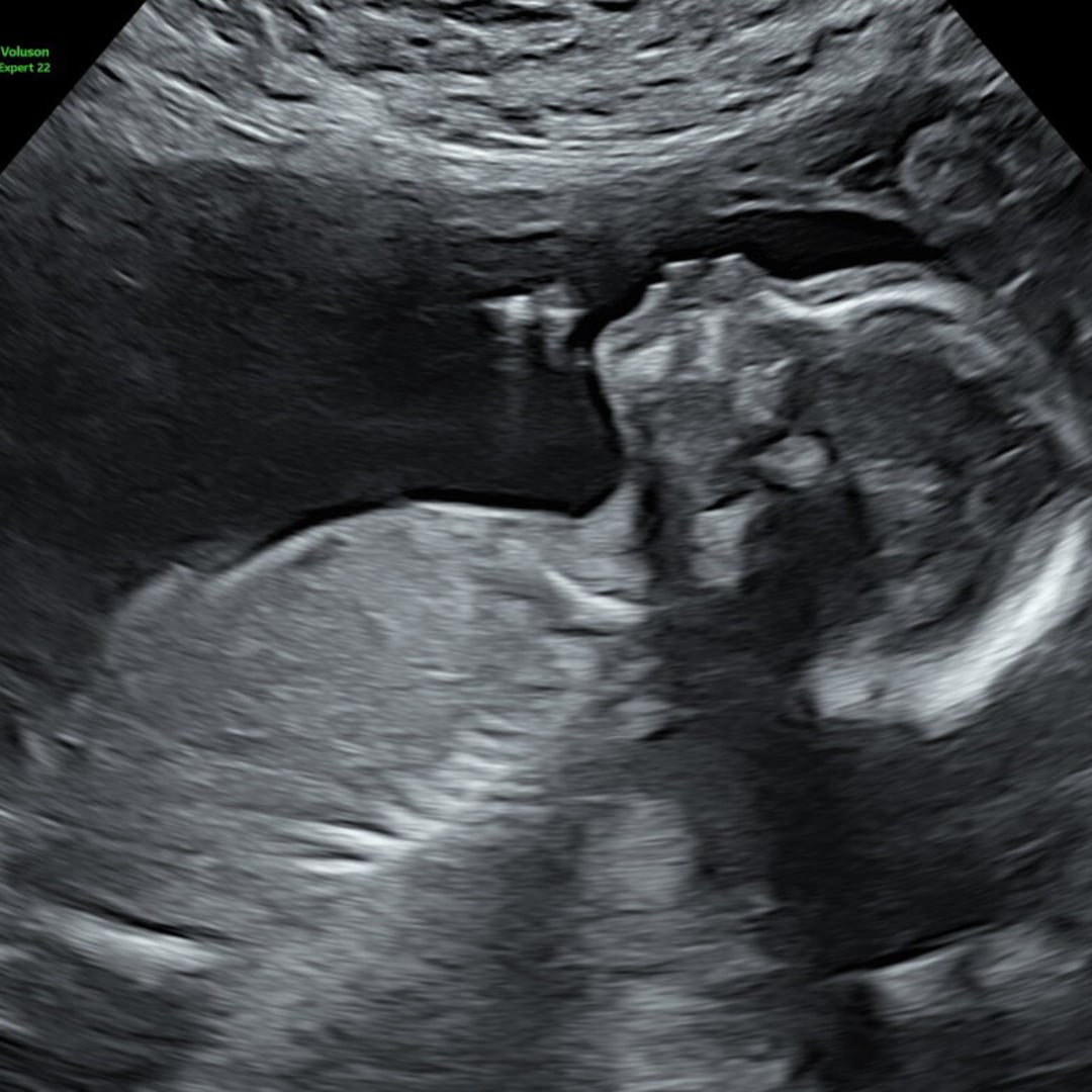 Photo shared by Elizabeth for their Babylist baby registry.