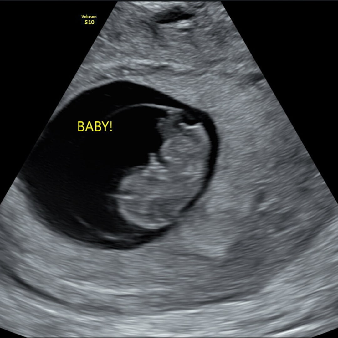 Photo shared by Ciara for their Babylist baby registry.