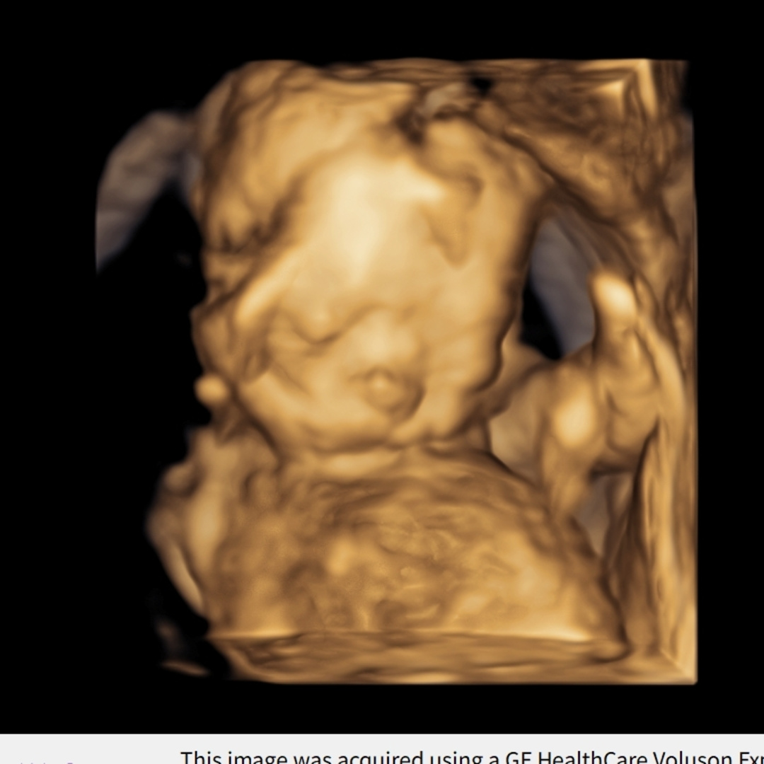 Photo shared by Ashlyn for their Babylist baby registry.