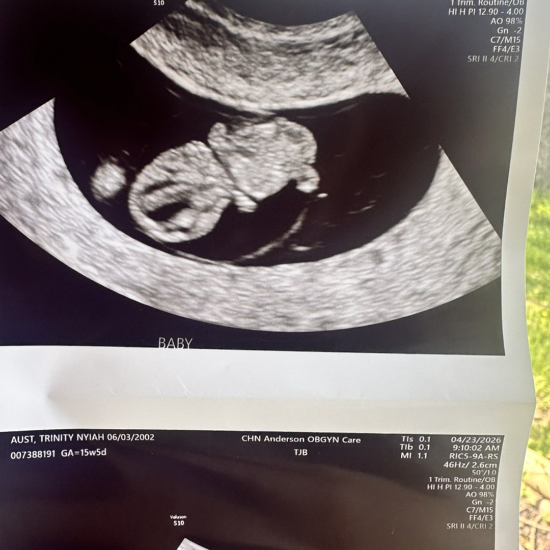 Photo shared by Trinity for their Babylist baby registry.