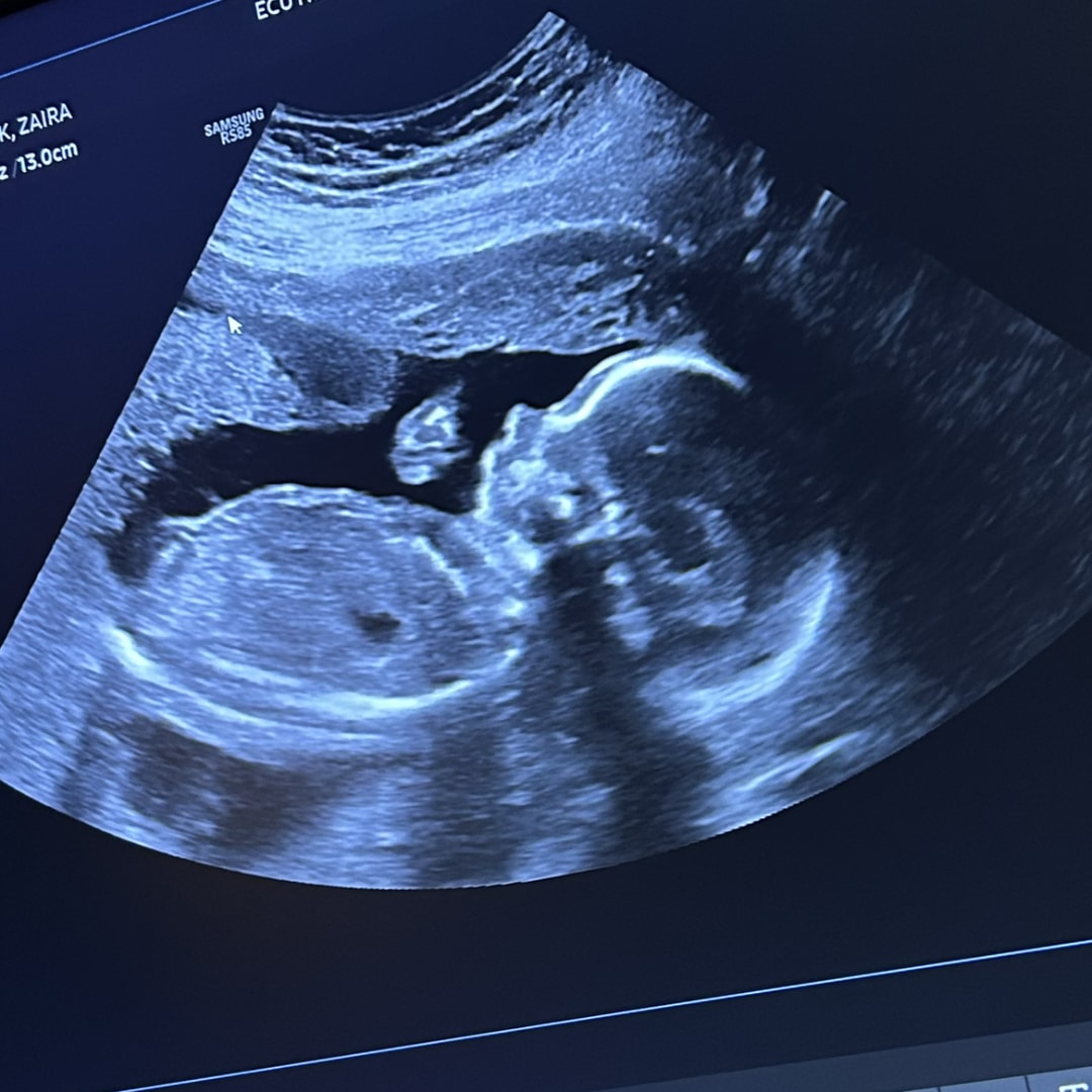 Photo shared by Zaira for their Babylist baby registry.