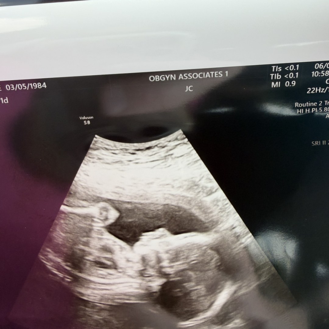 Photo shared by Jamie for their Babylist baby registry.