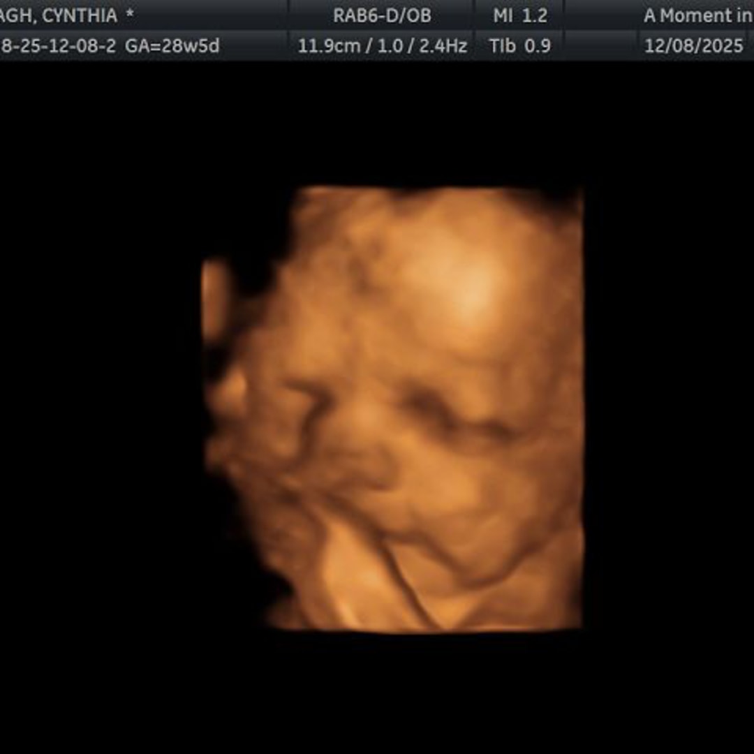 Photo shared by Cynthia for their Babylist baby registry.