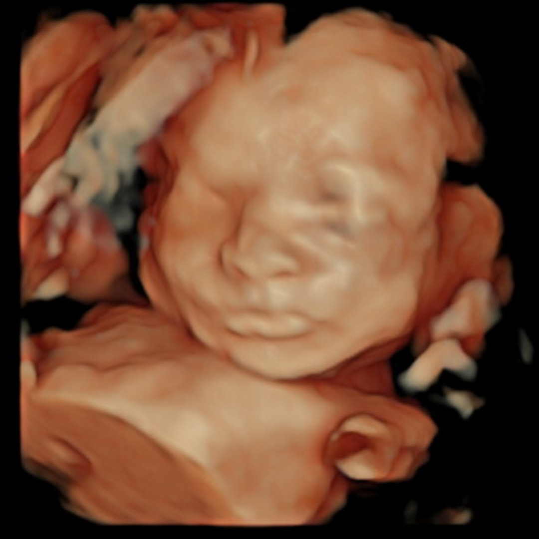 Photo shared by Jasmine for their Babylist baby registry.