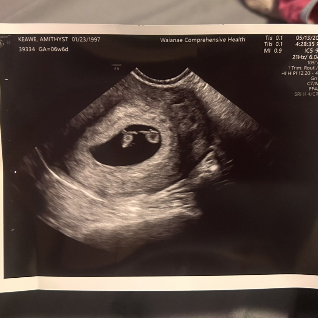 Photo shared by Amithyst for their Babylist baby registry.