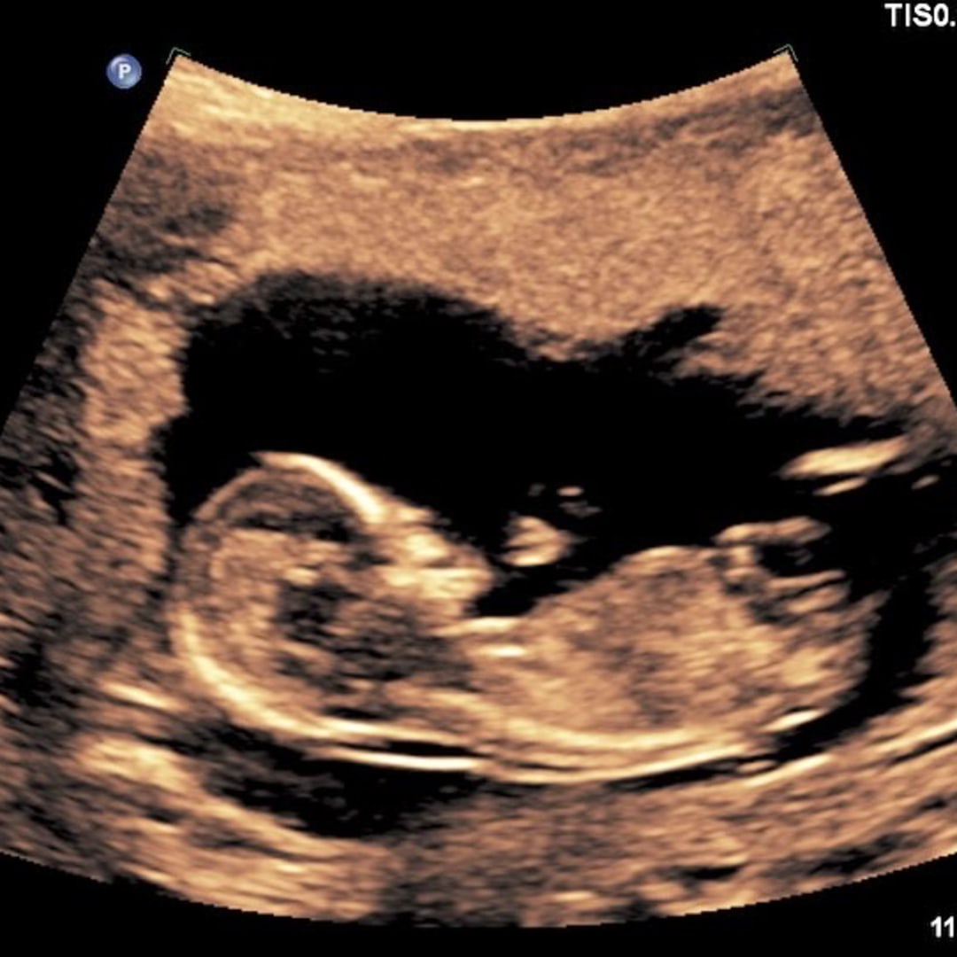 Photo shared by Alyssa for their Babylist baby registry.