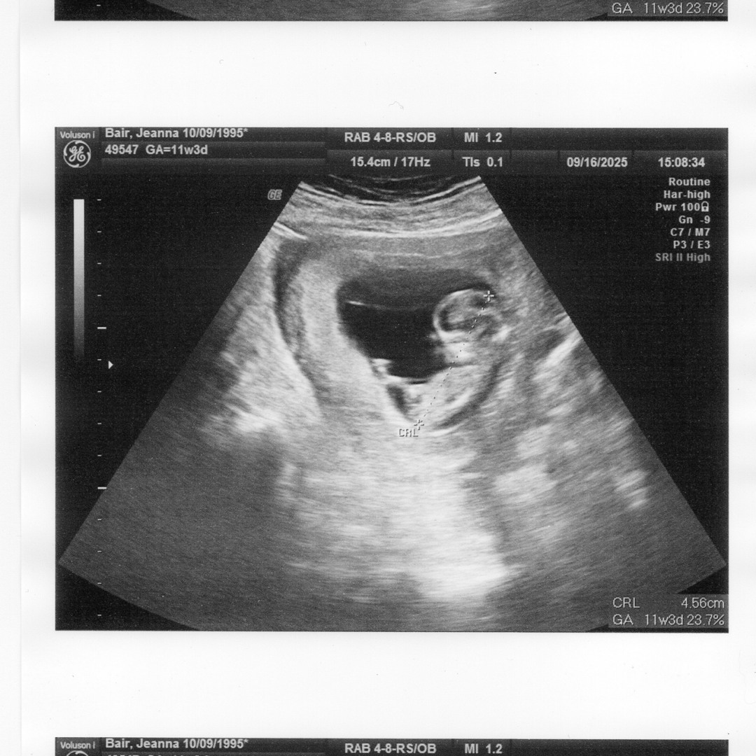 Photo shared by Caleb for their Babylist baby registry.