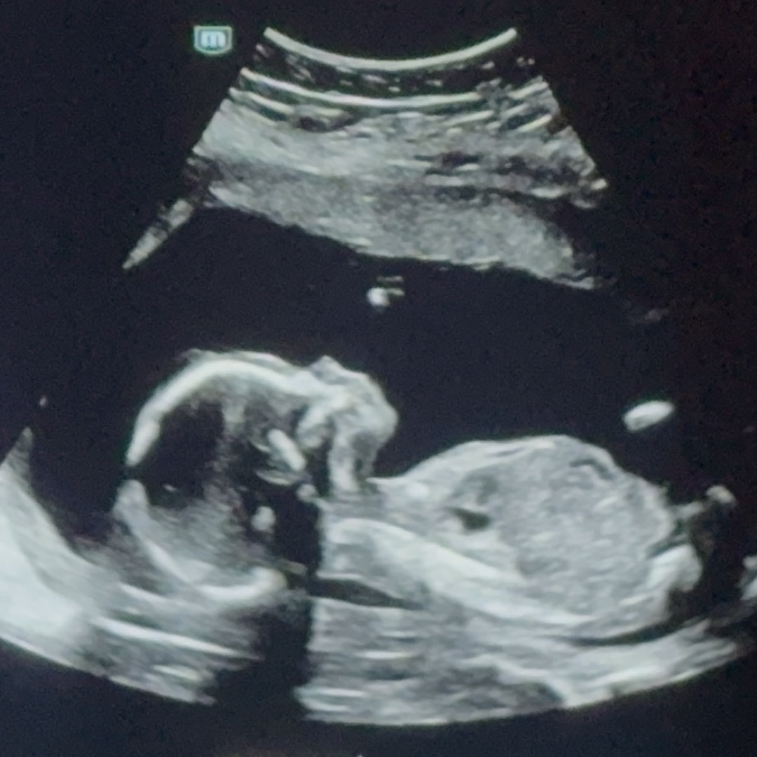 Photo shared by Caiton for their Babylist baby registry.