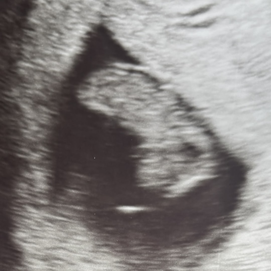 Photo shared by Jamie for their Babylist baby registry.