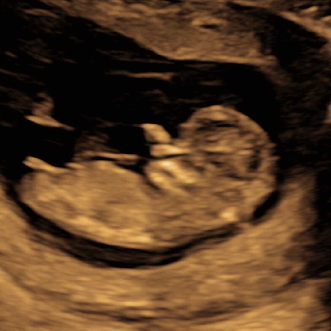 Photo shared by Erin for their Babylist baby registry.