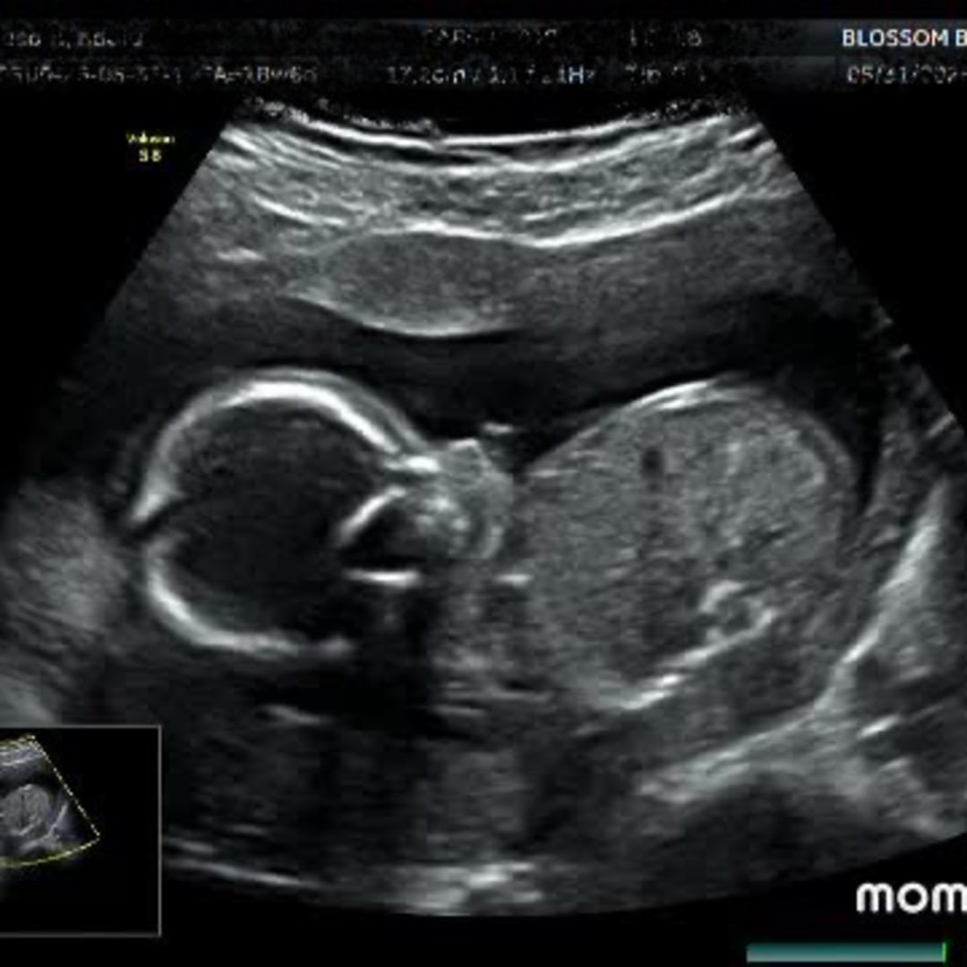 Photo shared by Nadia for their Babylist baby registry.