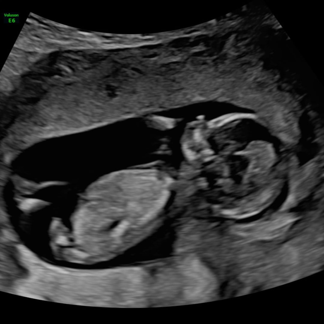 Photo shared by Jilian for their Babylist baby registry.