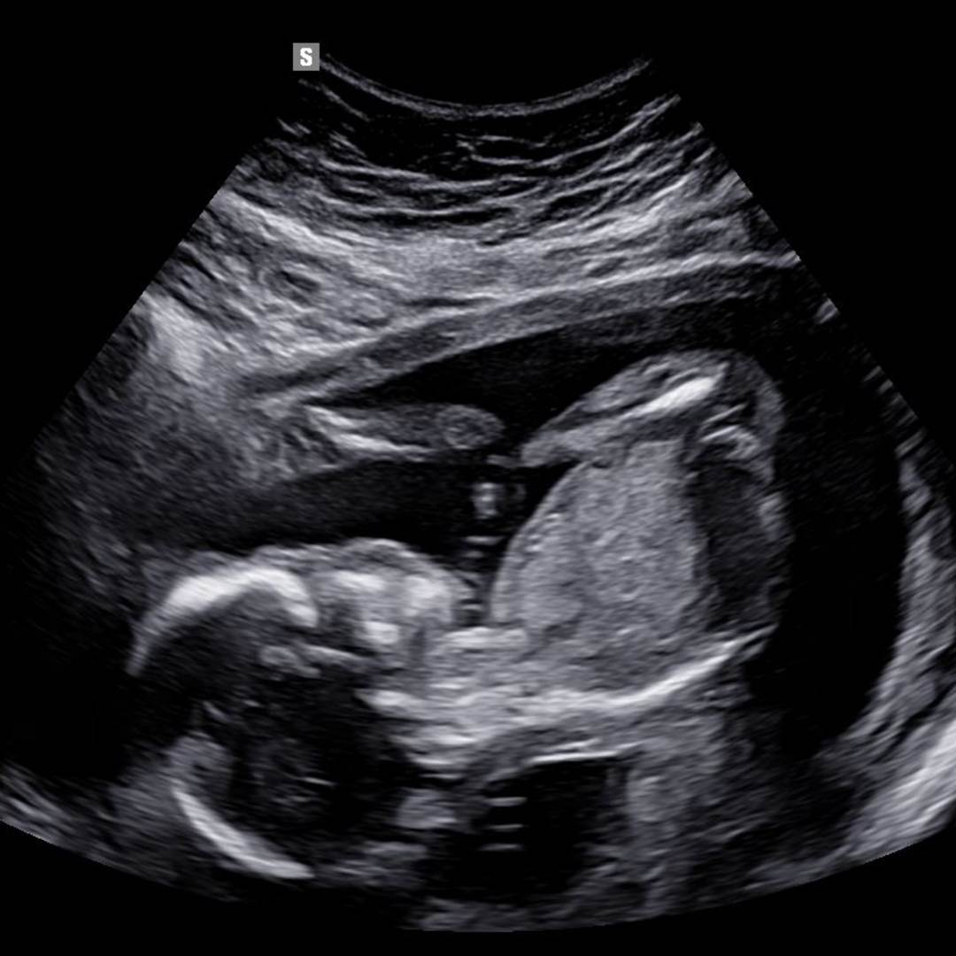 Photo shared by Alyssa for their Babylist baby registry.