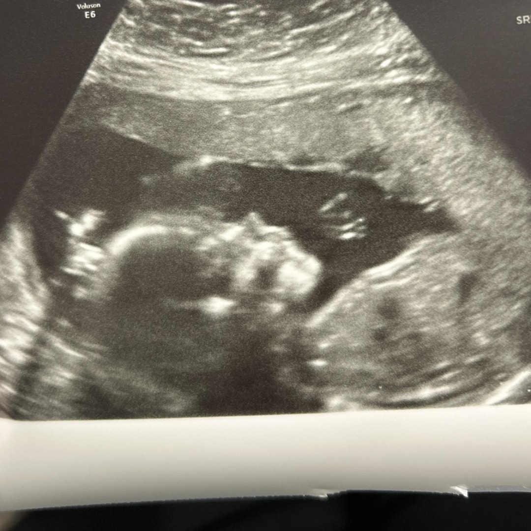 Photo shared by Breeze for their Babylist baby registry.