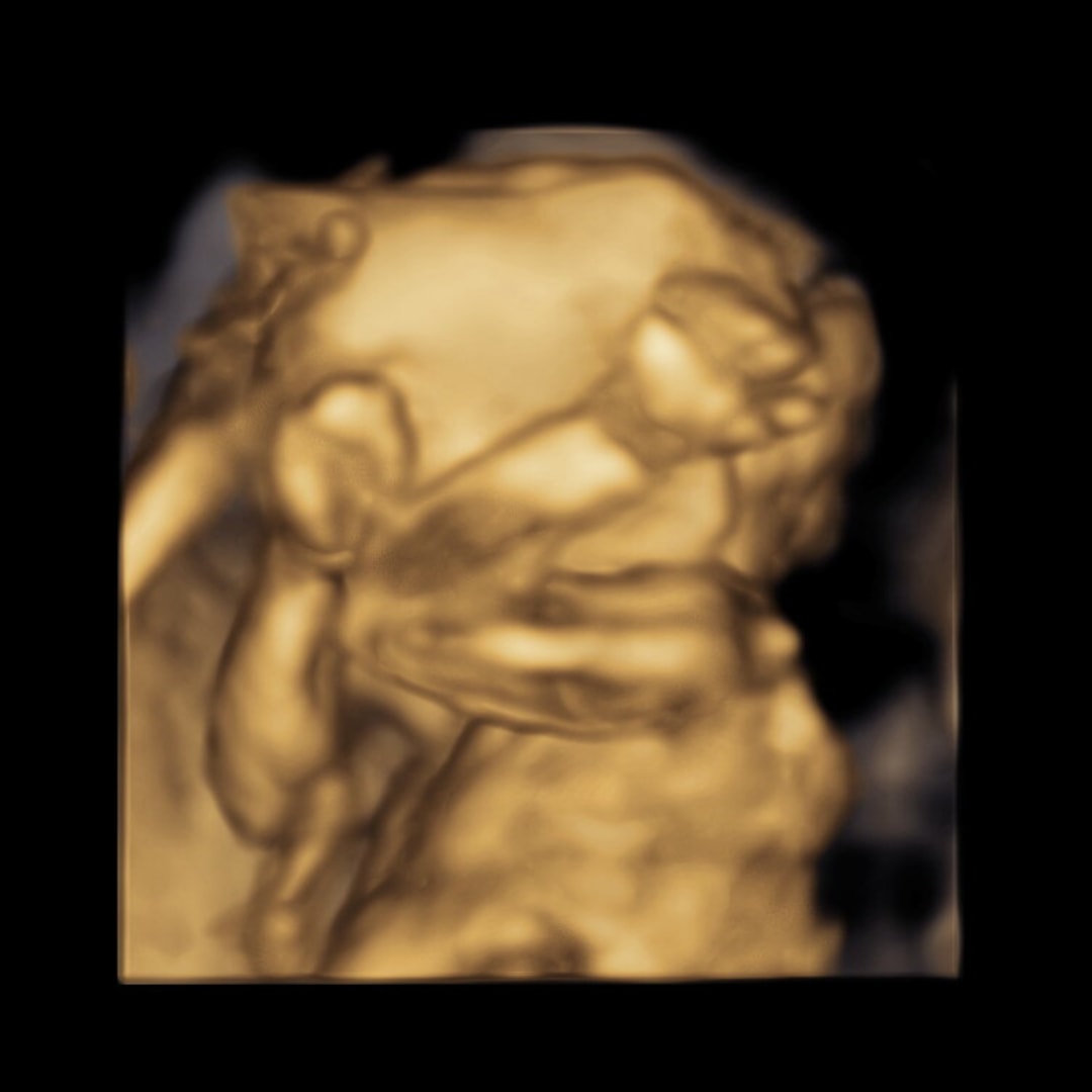 Photo shared by Josie for their Babylist baby registry.