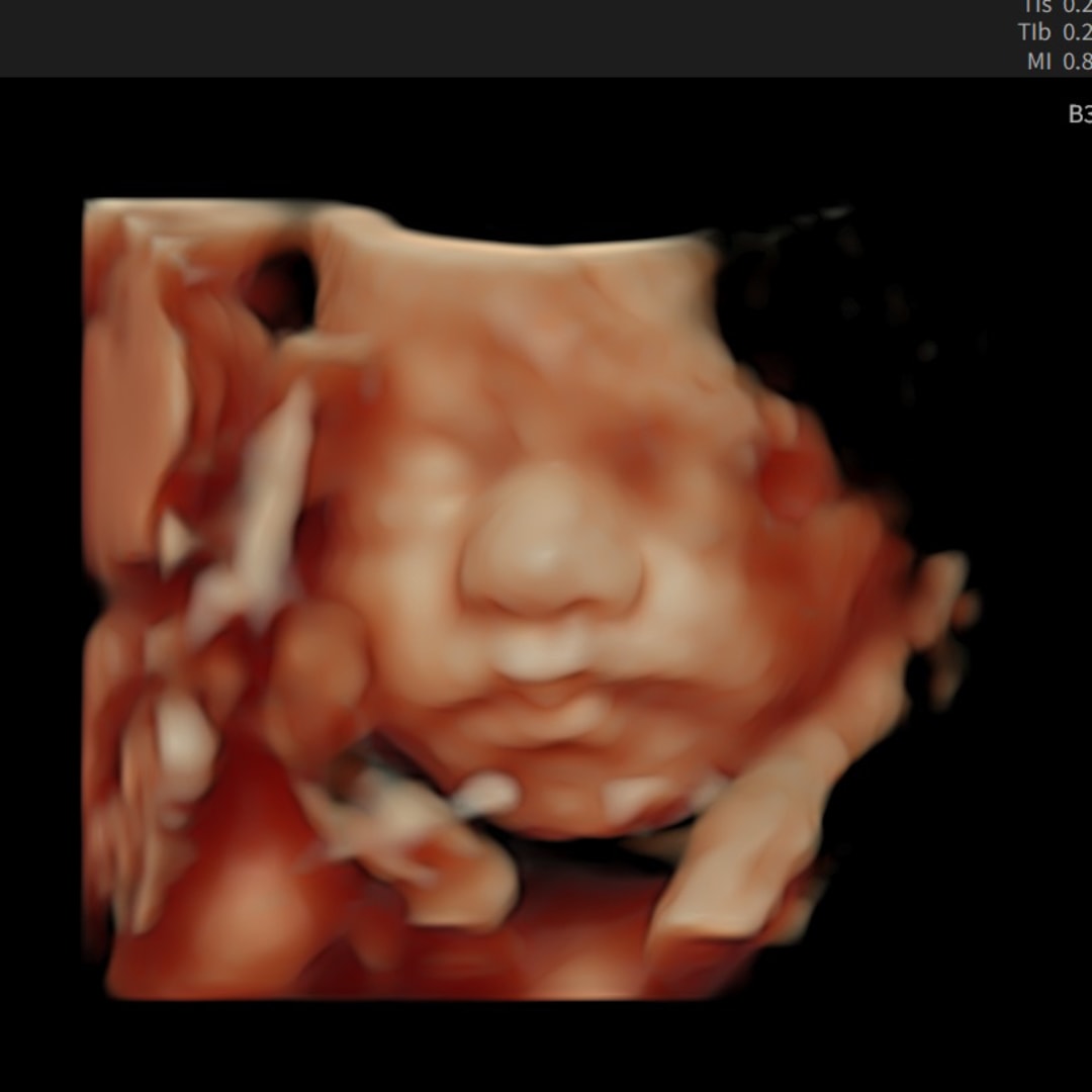 Photo shared by Abby for their Babylist baby registry.