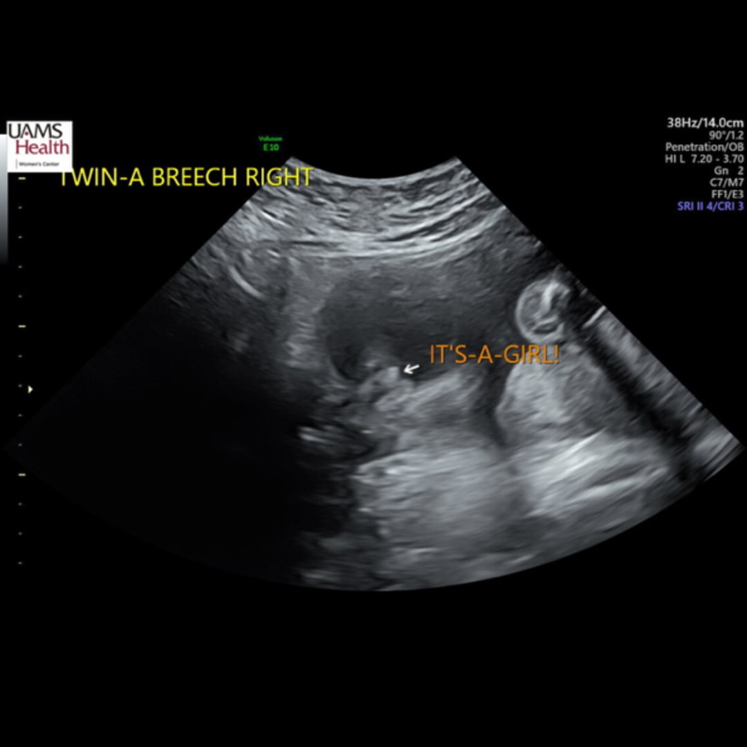 Photo shared by Cammy for their Babylist baby registry.