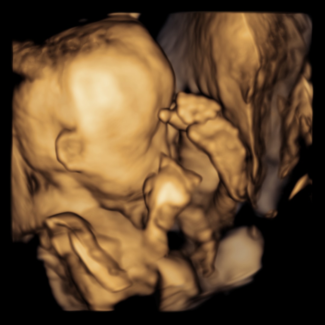 Photo shared by Miranda for their Babylist baby registry.