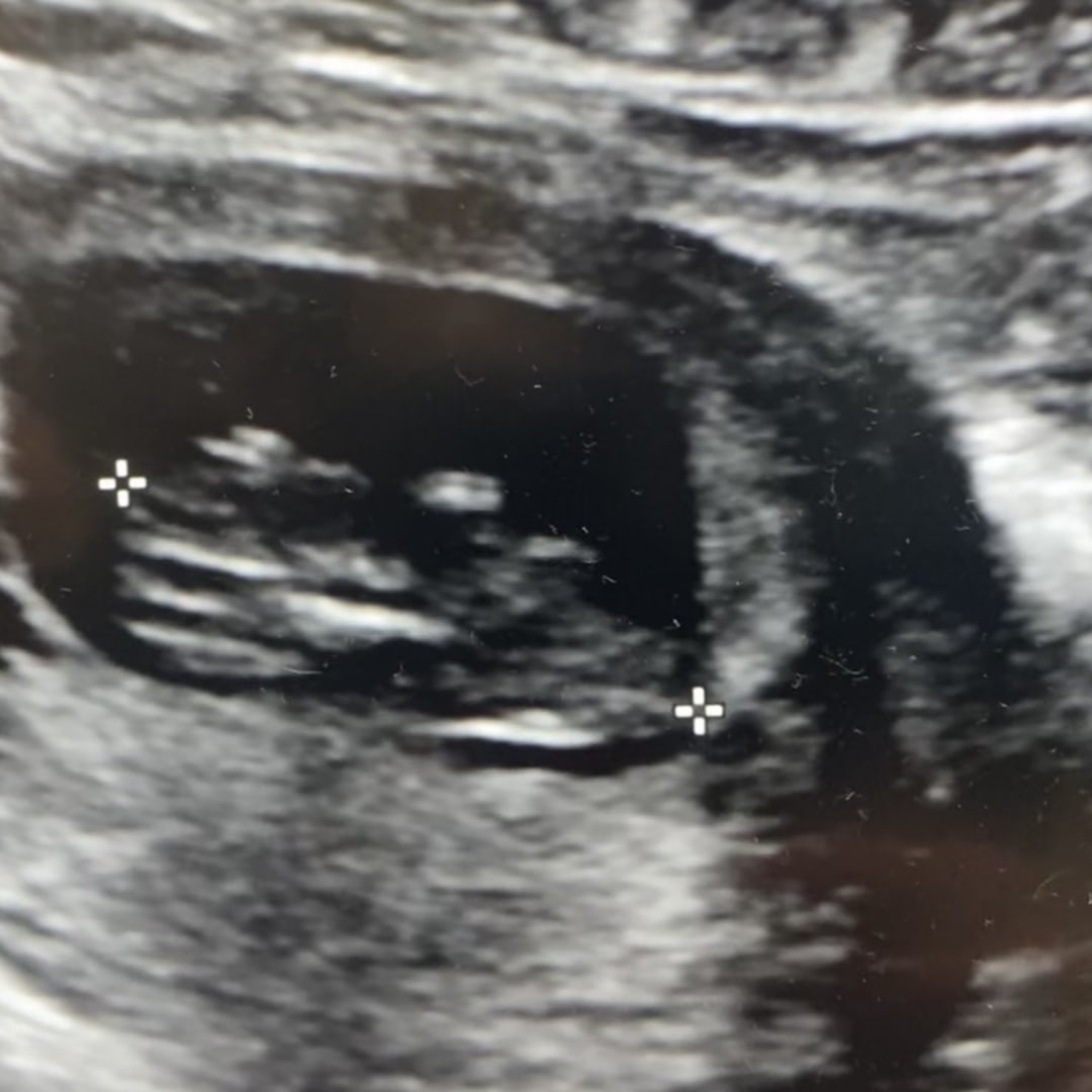 Photo shared by Kassandra for their Babylist baby registry.