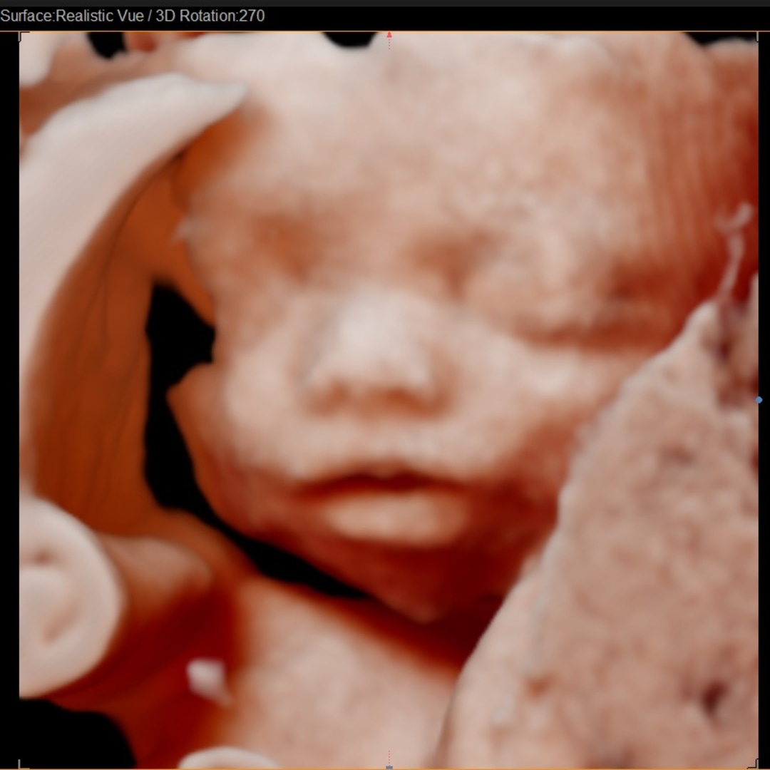 Photo shared by Montana for their Babylist baby registry.