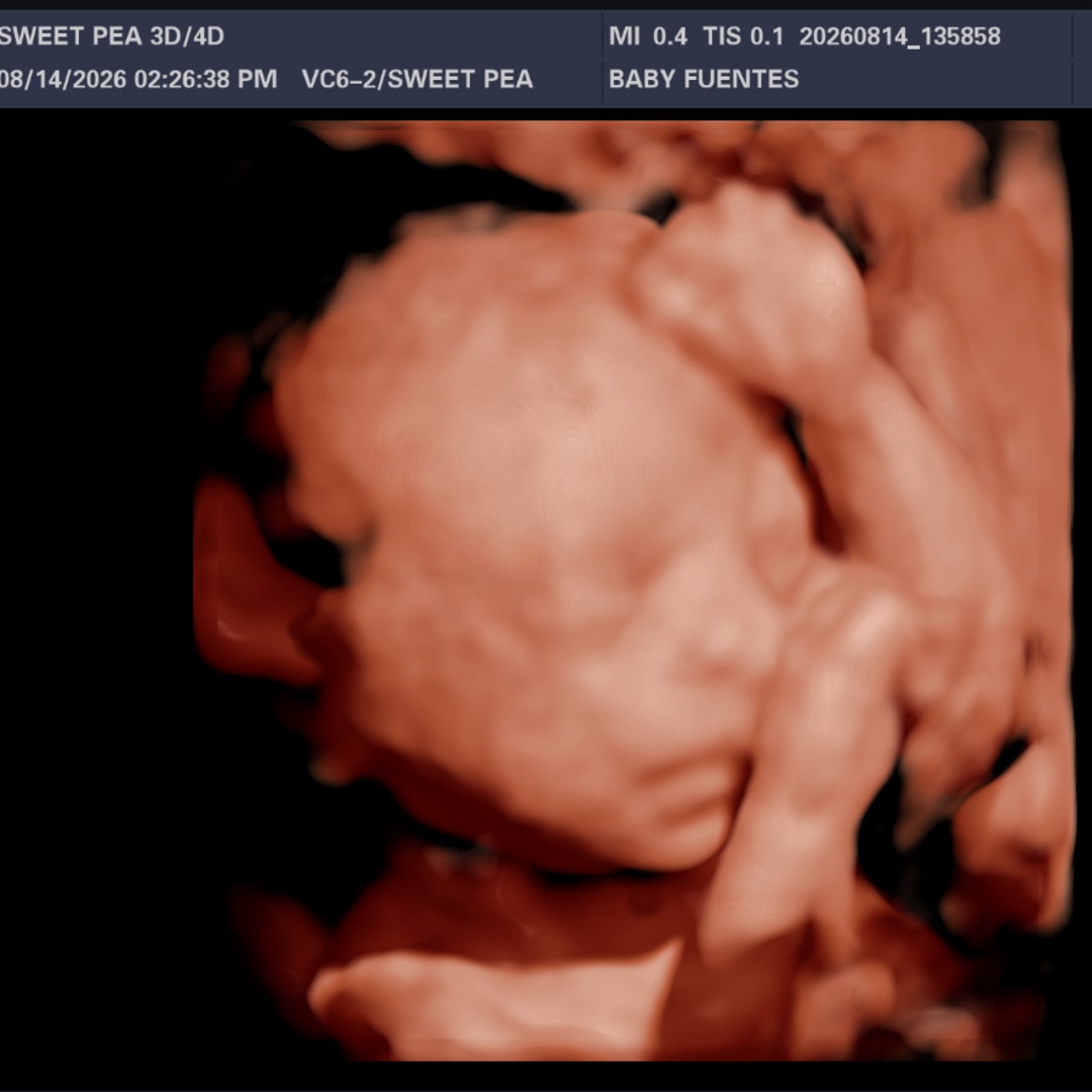 Photo shared by Megan for their Babylist baby registry.