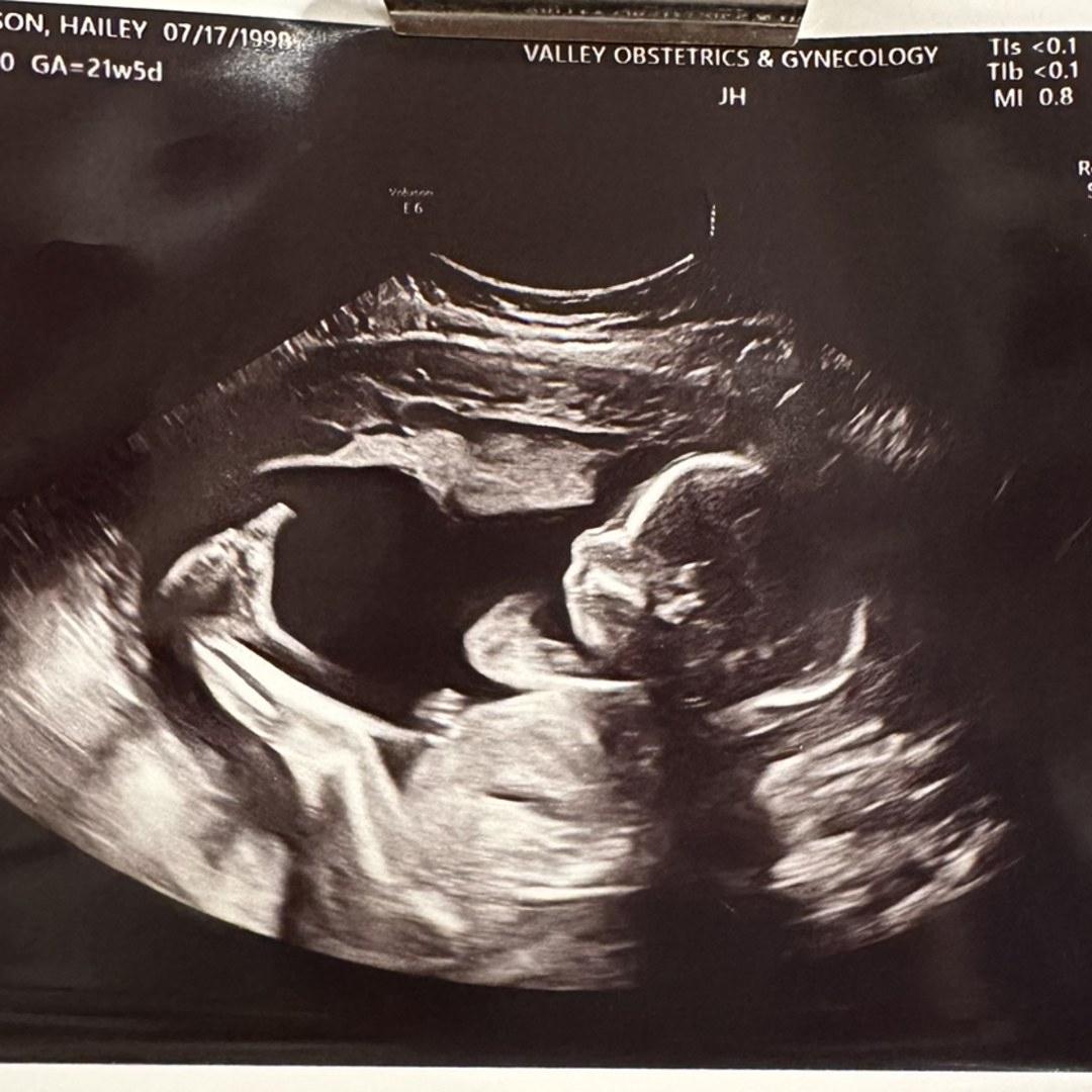 Photo shared by Hailey for their Babylist baby registry.