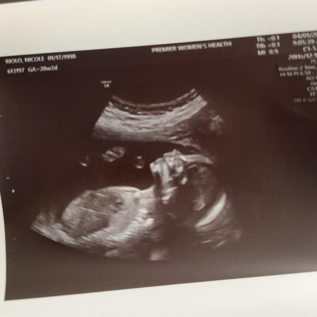 Photo shared by Nicole for their Babylist baby registry.