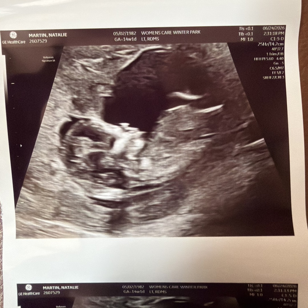 Photo shared by Natalie for their Babylist baby registry.