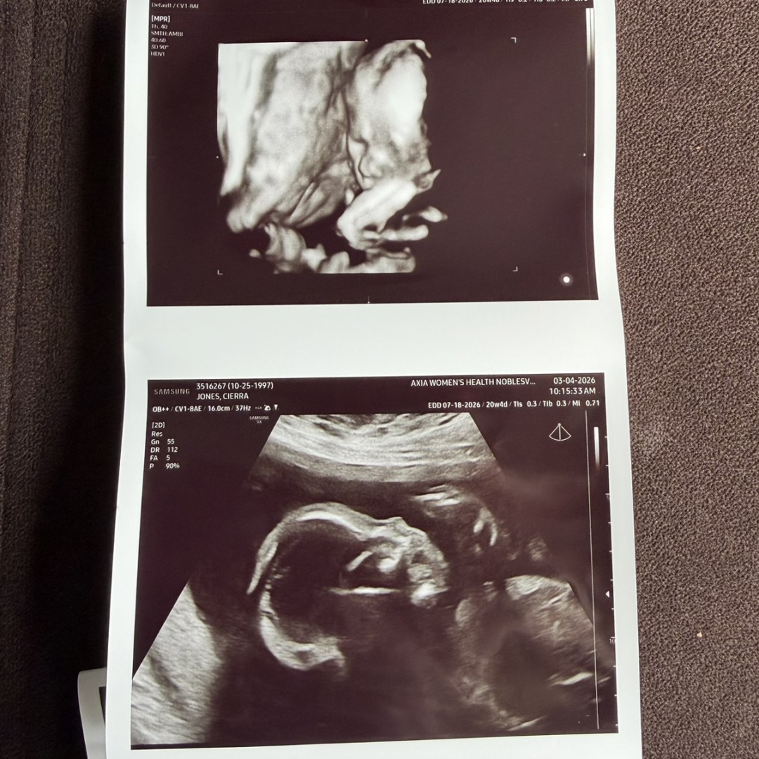 Photo shared by Cierra for their Babylist baby registry.